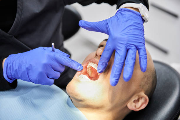 Best Emergency Tooth Extraction in Clear Lake Shores, TX